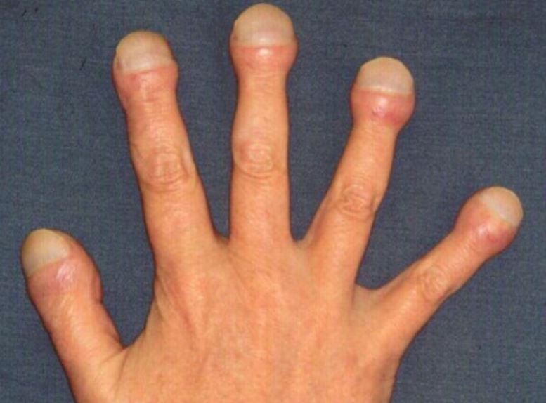 
               Meilleure image drole  Doigts de gland 
              