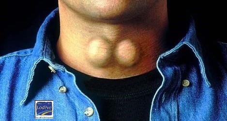 
               Meilleures images droles  les boules 
              